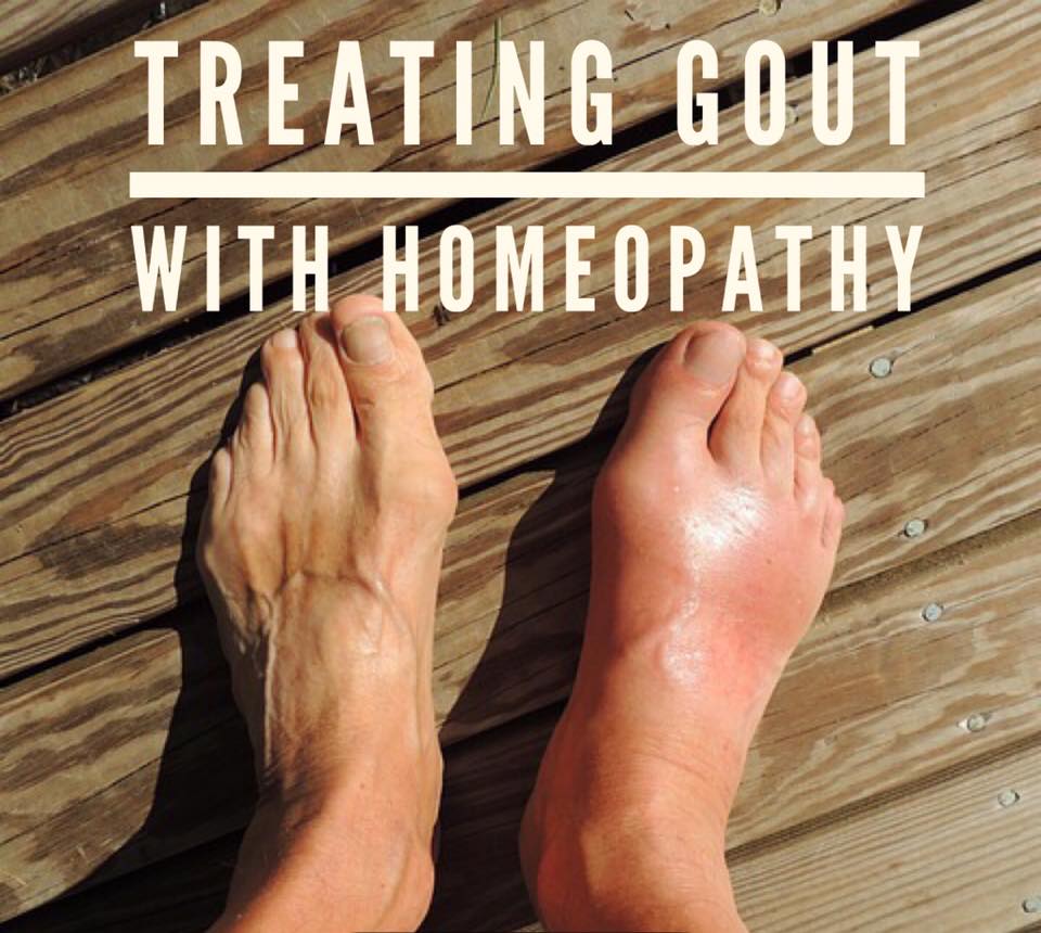 Gout and Homeopathic Approach