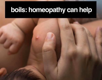 Treat boils with Homeopathic Remedies.