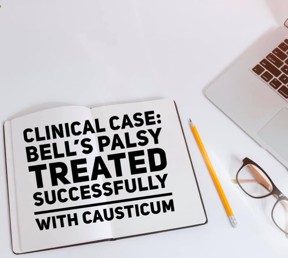 Bell's Palsy's Clinical Case