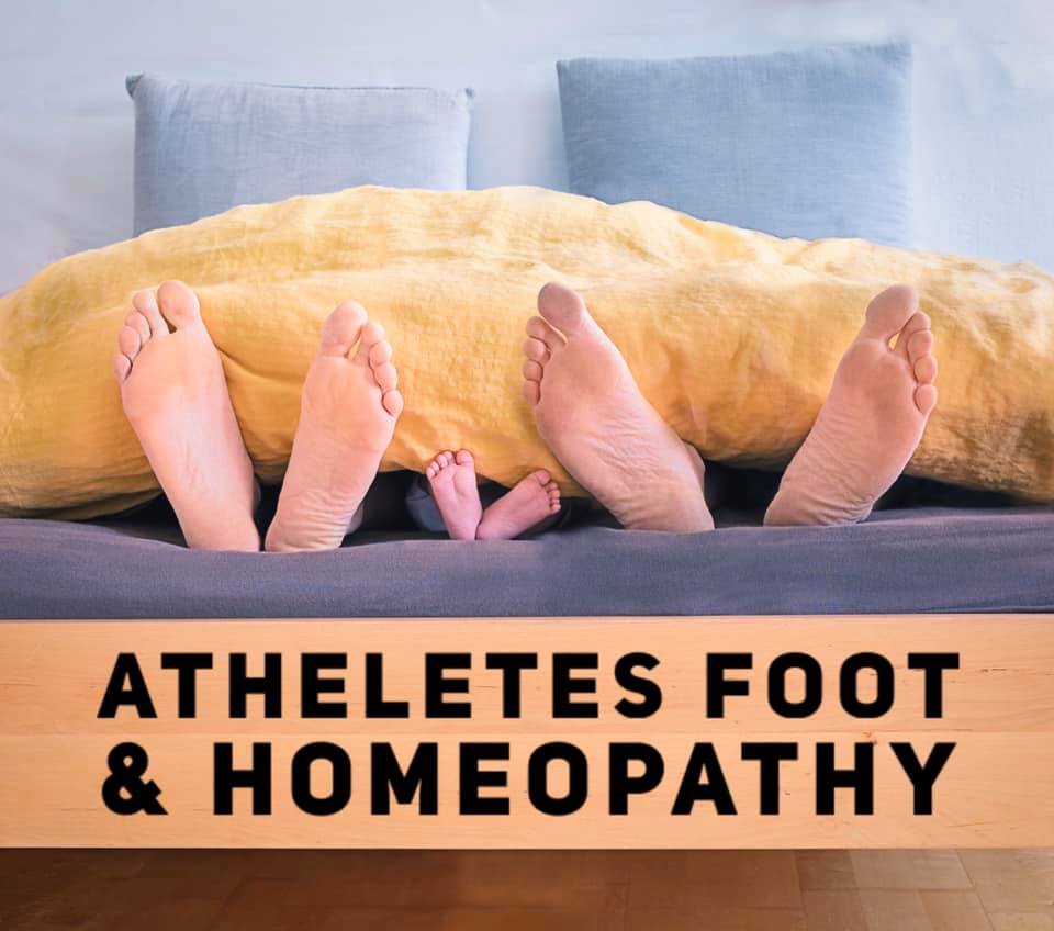 Tinea (Athlete's foot) - Homeopathy Treatment and Homeopathic