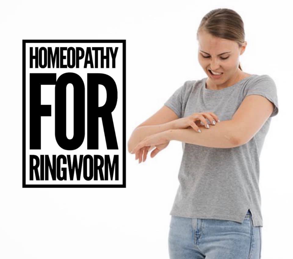 Ringworm  ONTARIO COLLEGE OF HOMEOPATHIC MEDICINE