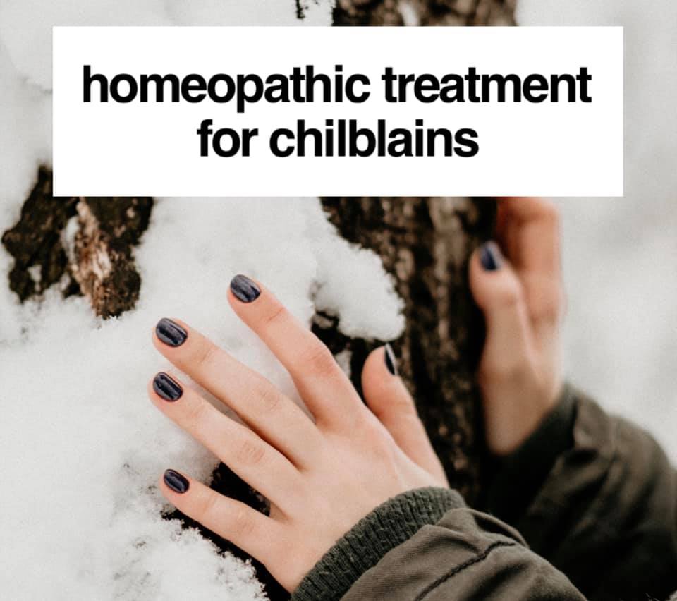 Chilblains